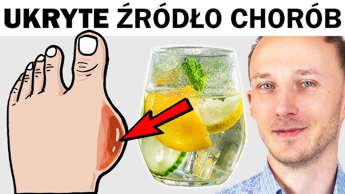 Powoli niszczy narządy. Wysoki kwas moczowy i jak go obniżyć