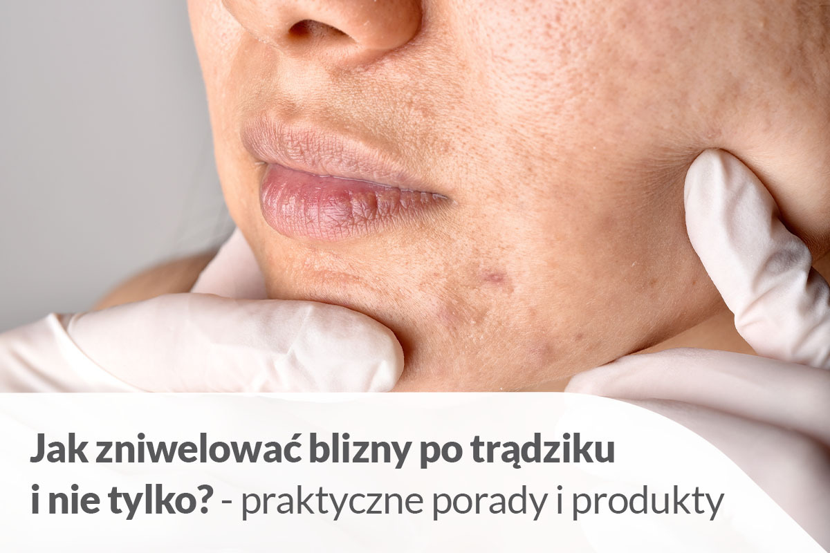 Jak pozbyć się blizn - Apteka internetowa e-medest.pl